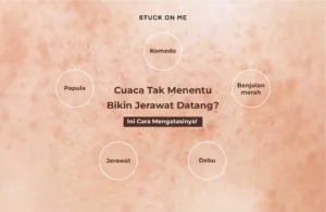 Cuaca Tak Menentu Bikin Jerawat Datang? Ini Cara Mengatasinya!