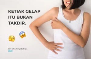 Ketiak Gelap Itu Bukan Takdir. Ini Penyebabnya!
