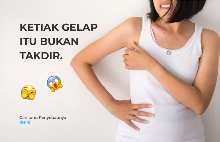 Ketiak Gelap Itu Bukan Takdir. Ini Penyebabnya!